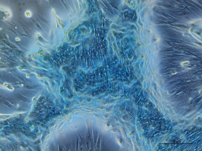 Foto El Microcosmos de la Condrogénesis